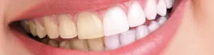 dentistas-gratuitos-en-madrid-acceso-a-una-sonrisa-saludable-sin-coste-alguno